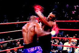 Tyson